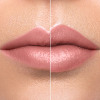 close up before and after treatment image of female lips