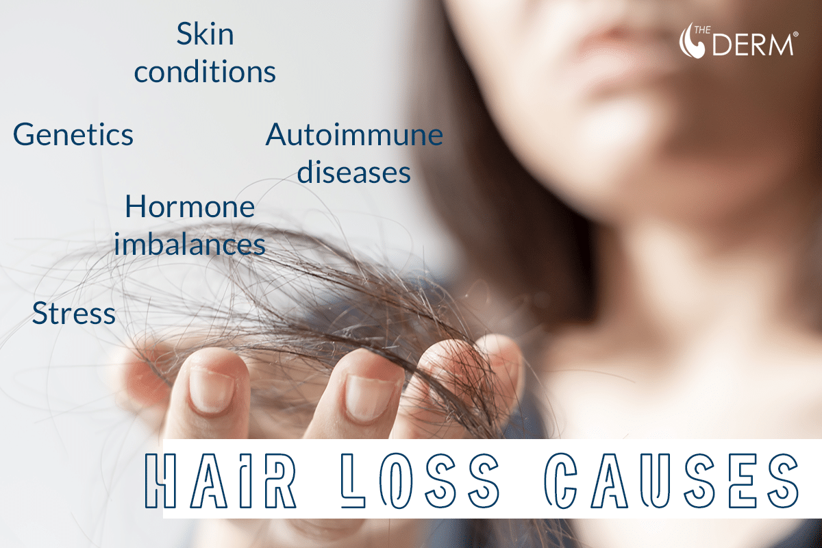 hair loss causes