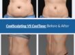 coolsculpting vs cooltone before and after