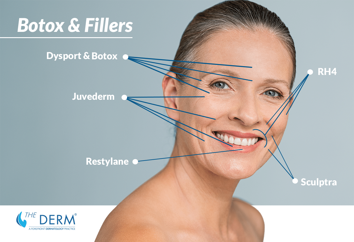 botox and fillers
