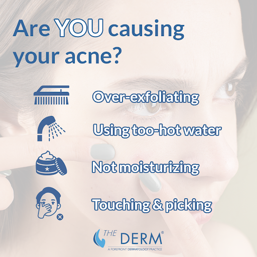acne causes