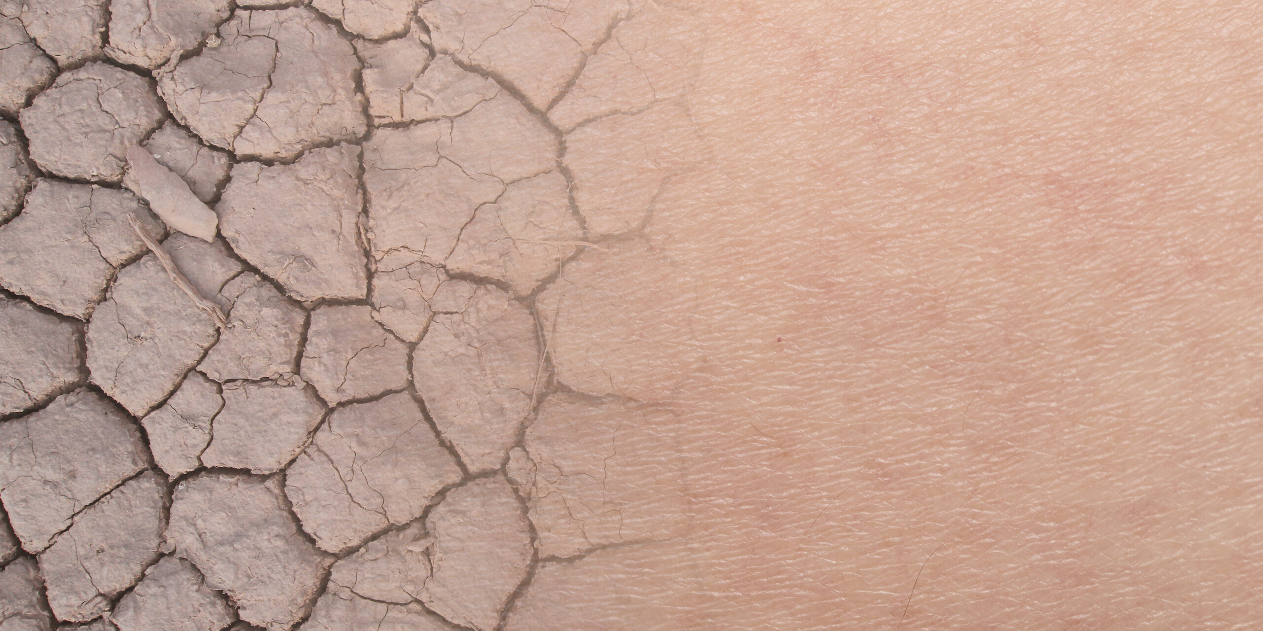 What is dehydrated skin? The Derm Dermatologists in Cook County, IL