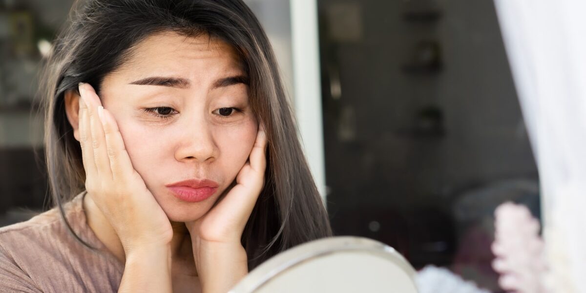 Asian woman having problem with eyes bags , dark circles, wrinkle and crow’s feet on her face skin