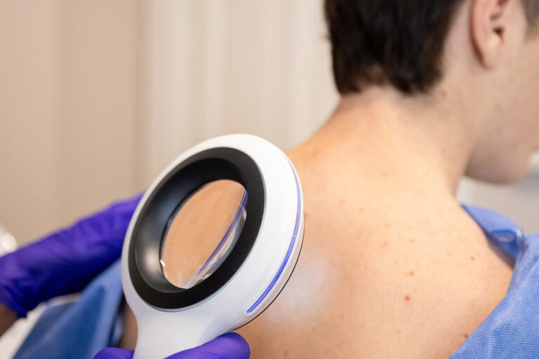 ffd_blog_skin-cancer-stats-you-cant-afford-to-ignore Dermatologist examining her patient with a dermatological magnifying glass