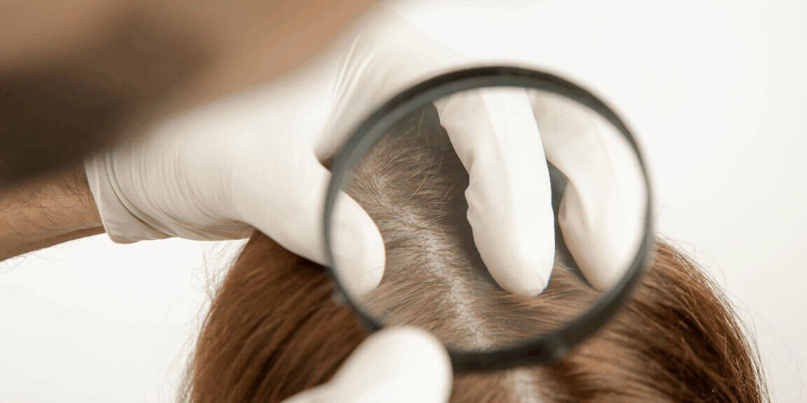 From Hair Loss to Hair Removal