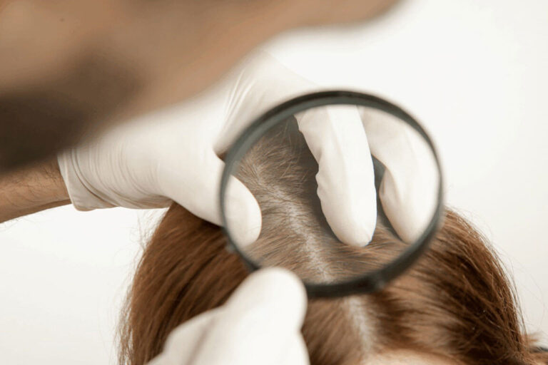 hair-loss-copy-1152×768 From Hair Loss to Hair Removal